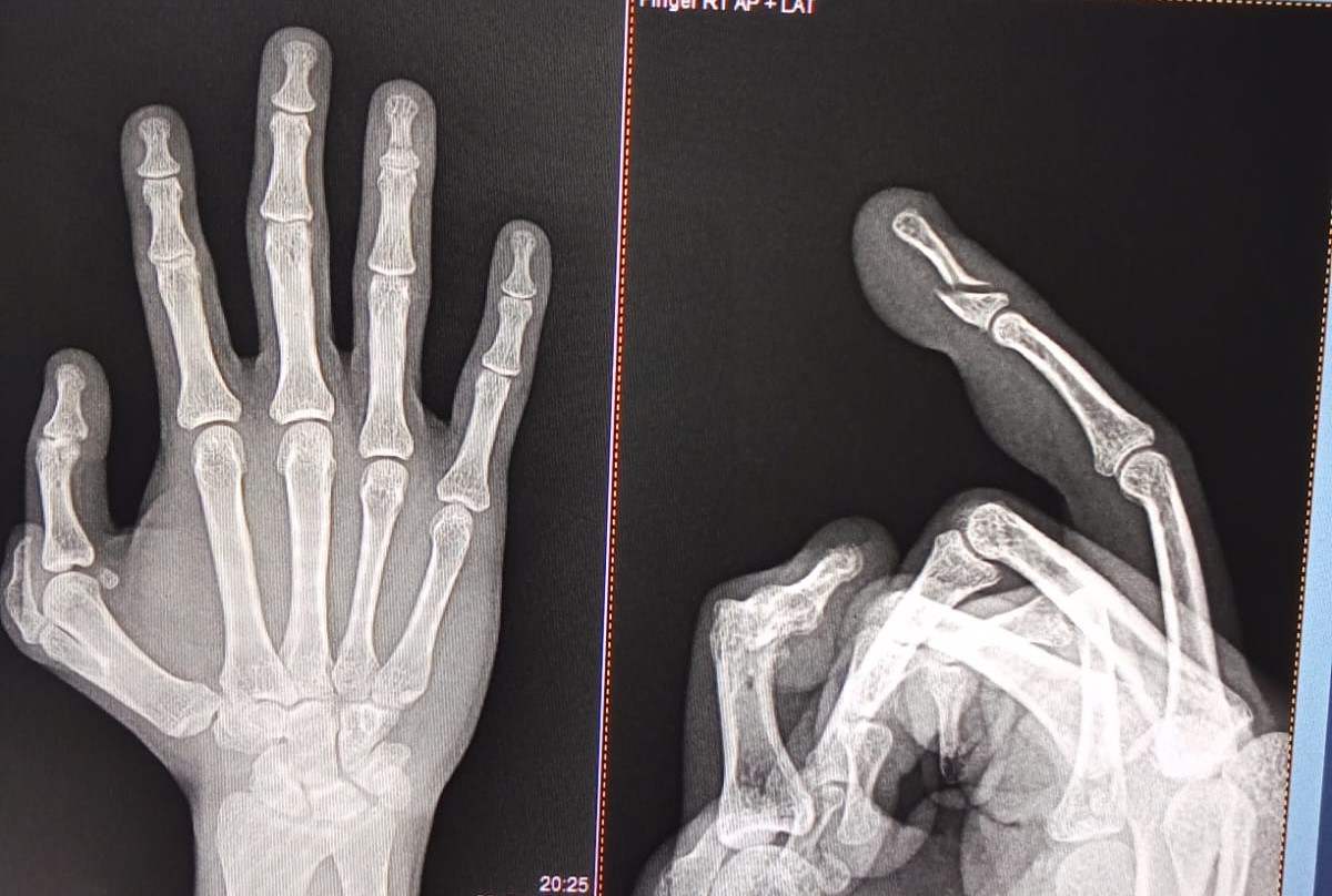 Integrity hospital orthopaedic department treats s... main image