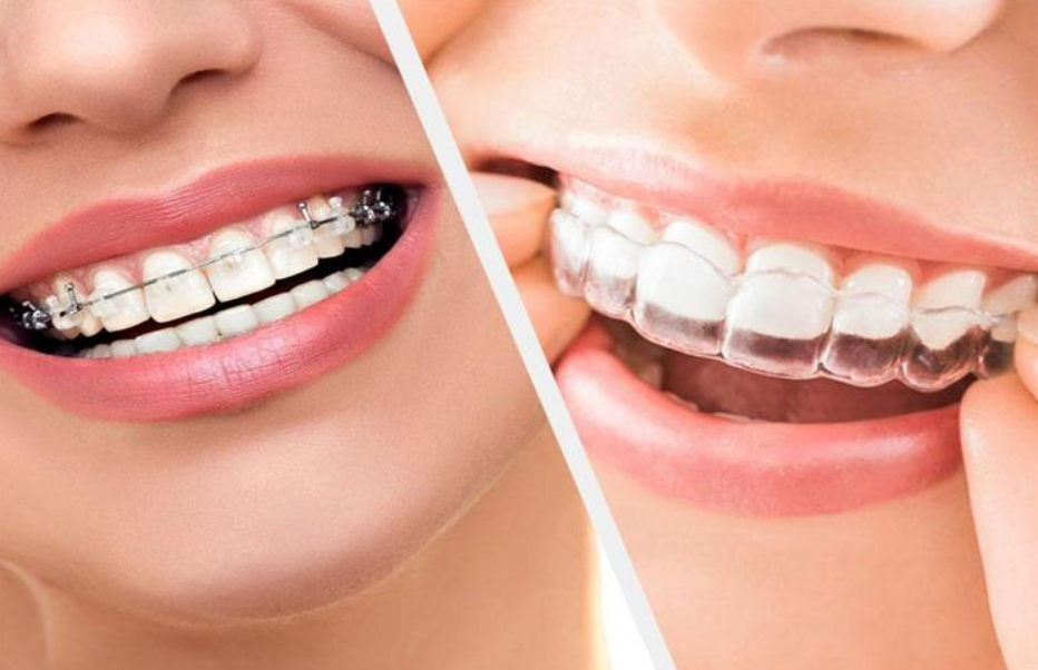 Braces and Beyond: Orthodontic Solutions at Dr. Ra... main image
