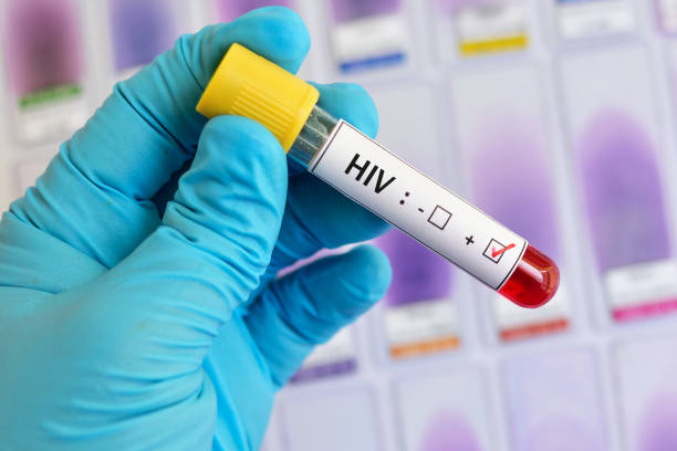 Navigating HIV Treatment: A 25-Year Legacy in H... main image