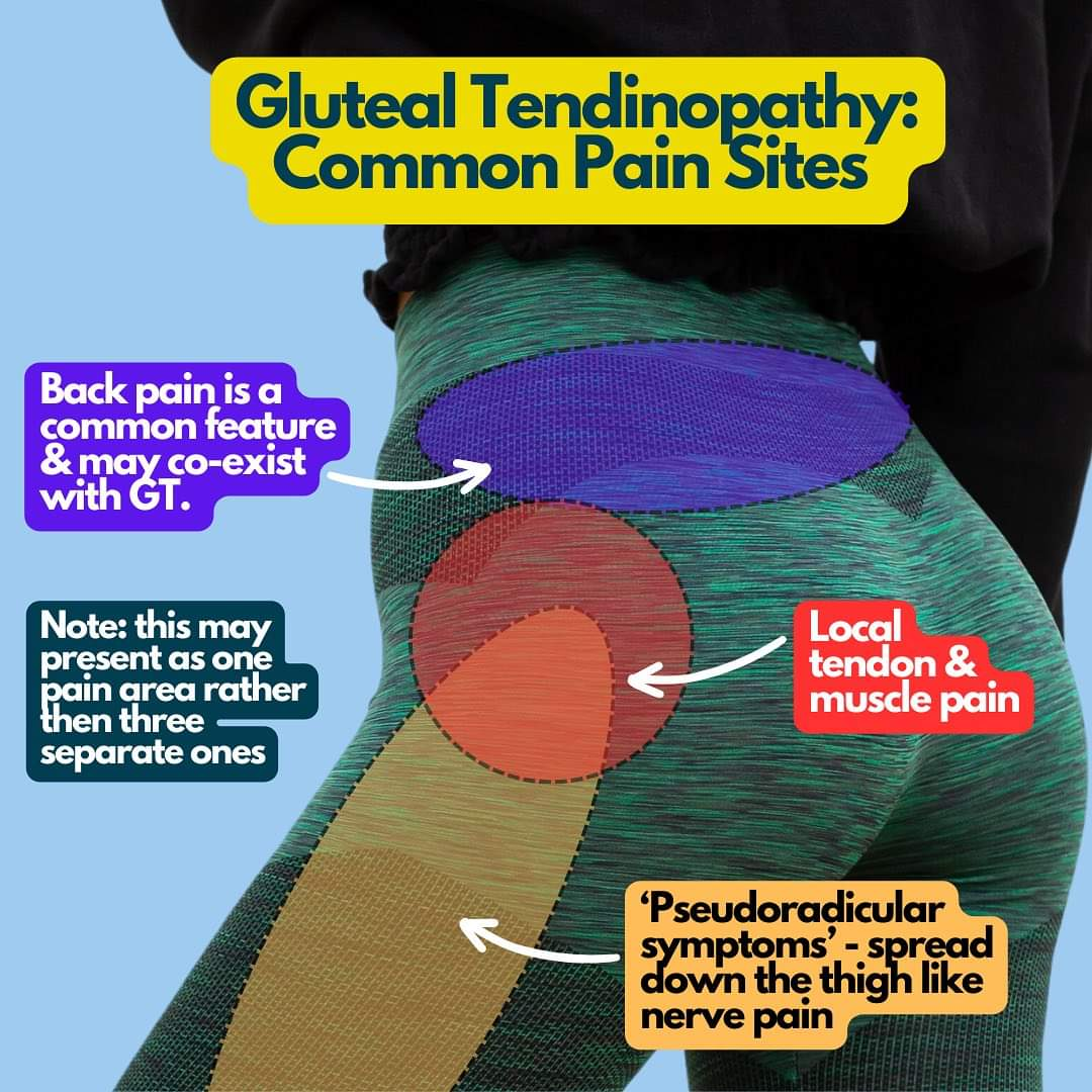 Physiotherapy clinic in Tambaram
Are you Looking f... main image