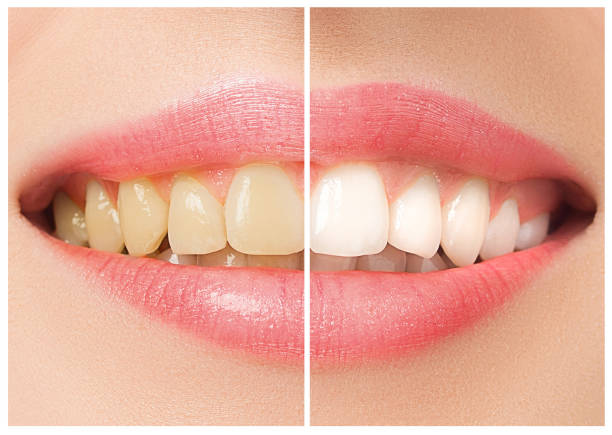Transformative Cosmetic Procedures: Medisky's E... main image