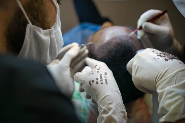 Hair Replacement Mastery: Eloraa Cliniq's Prefe... main image