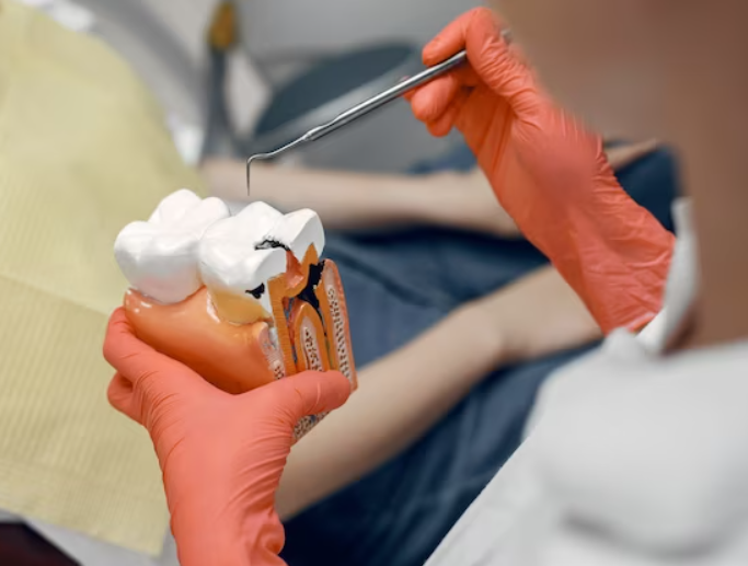 Painless RCT at Dr. Rai's Dental Avenue: Offering ... main image