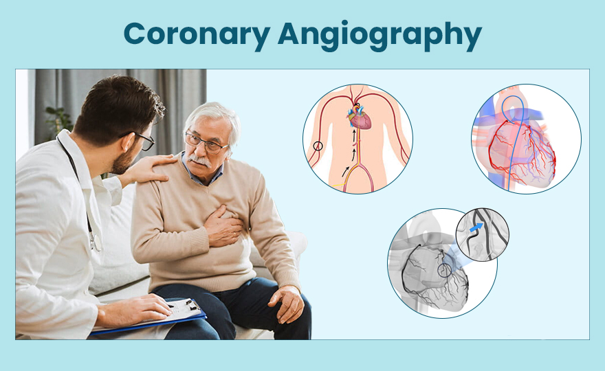 Angiography is a medical imaging technique used... main image