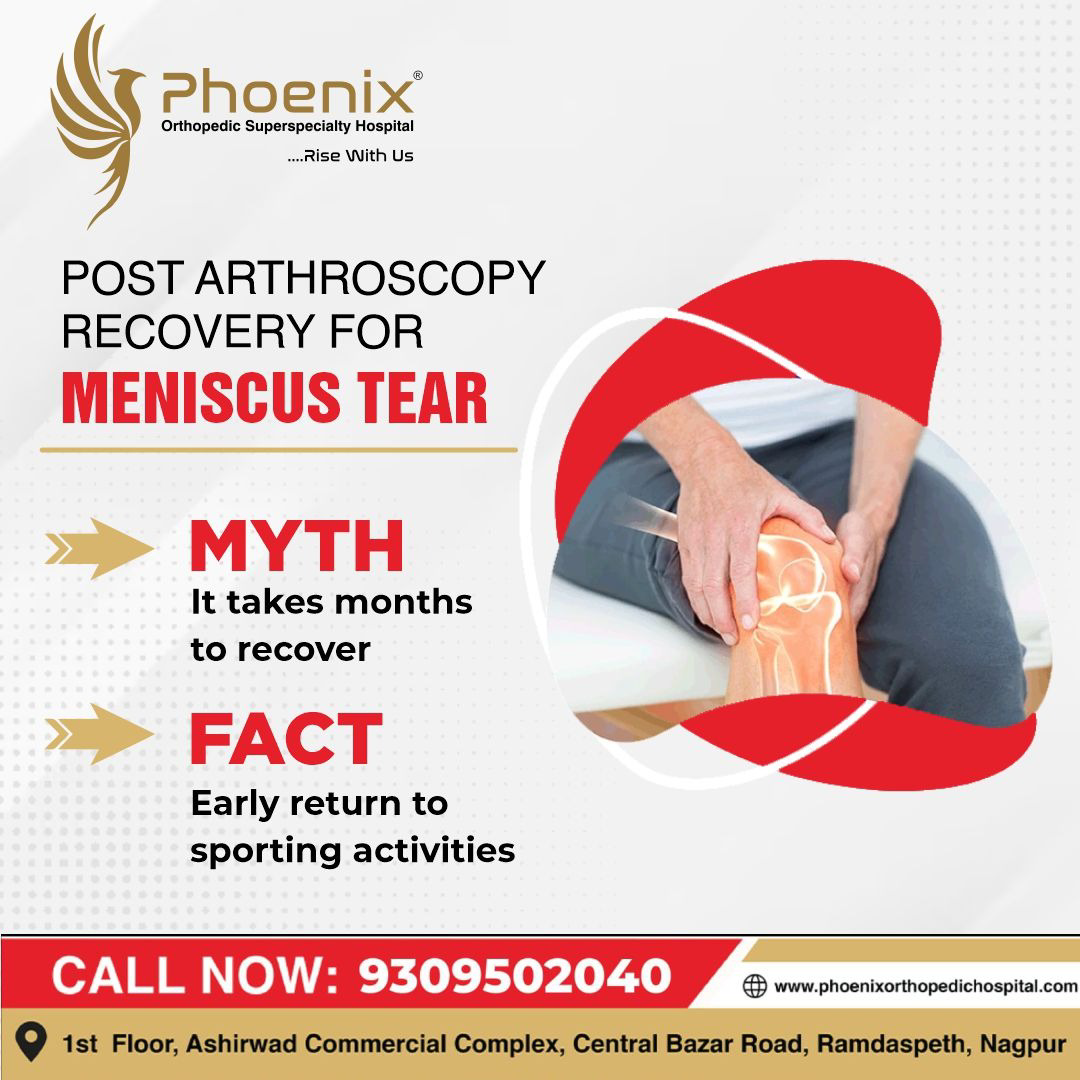 Recovery after arthroscopic surgery for a meniscus... main image