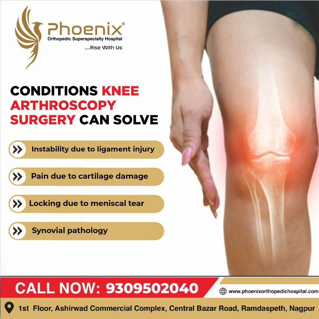 Knee arthroscopy surgery can help address various ... main image