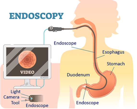 Advancements in Endoscopy and Laparoscopy at SA... main image