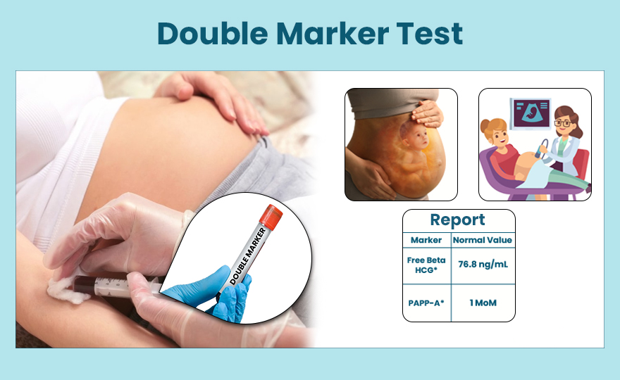 The dual marker test, also known as the double ... main image