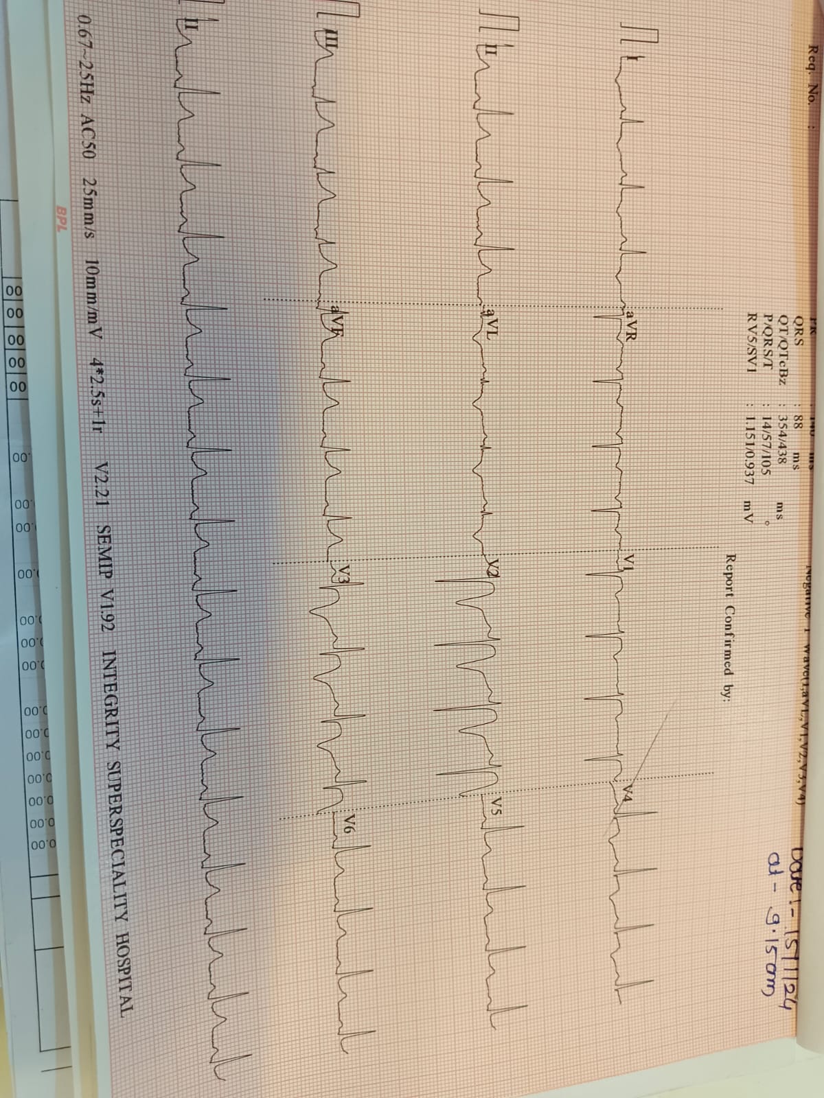 An Electrocardiogram (ECG or EKG) is a crucial dia... main image