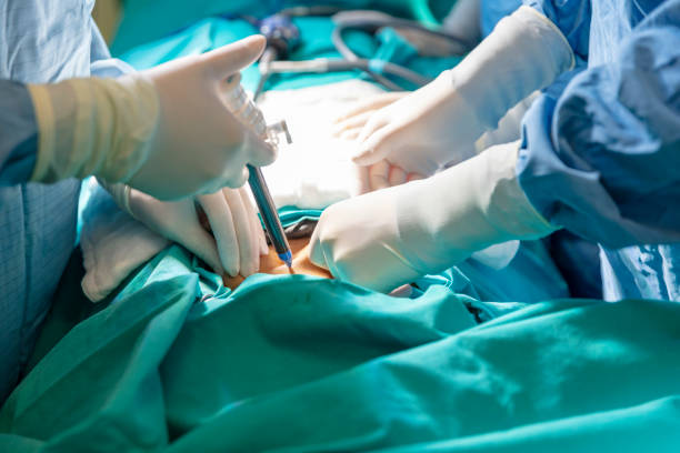 Surgical Brilliance: Dr. Rajiv Manek - Laparosc... main image