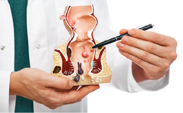 Finding the Best Piles Doctor in Pune: A Compre... main image