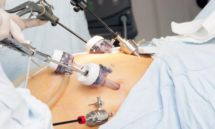 Gynae Laparoscopy in Najafgarh

Gynecological l... main image