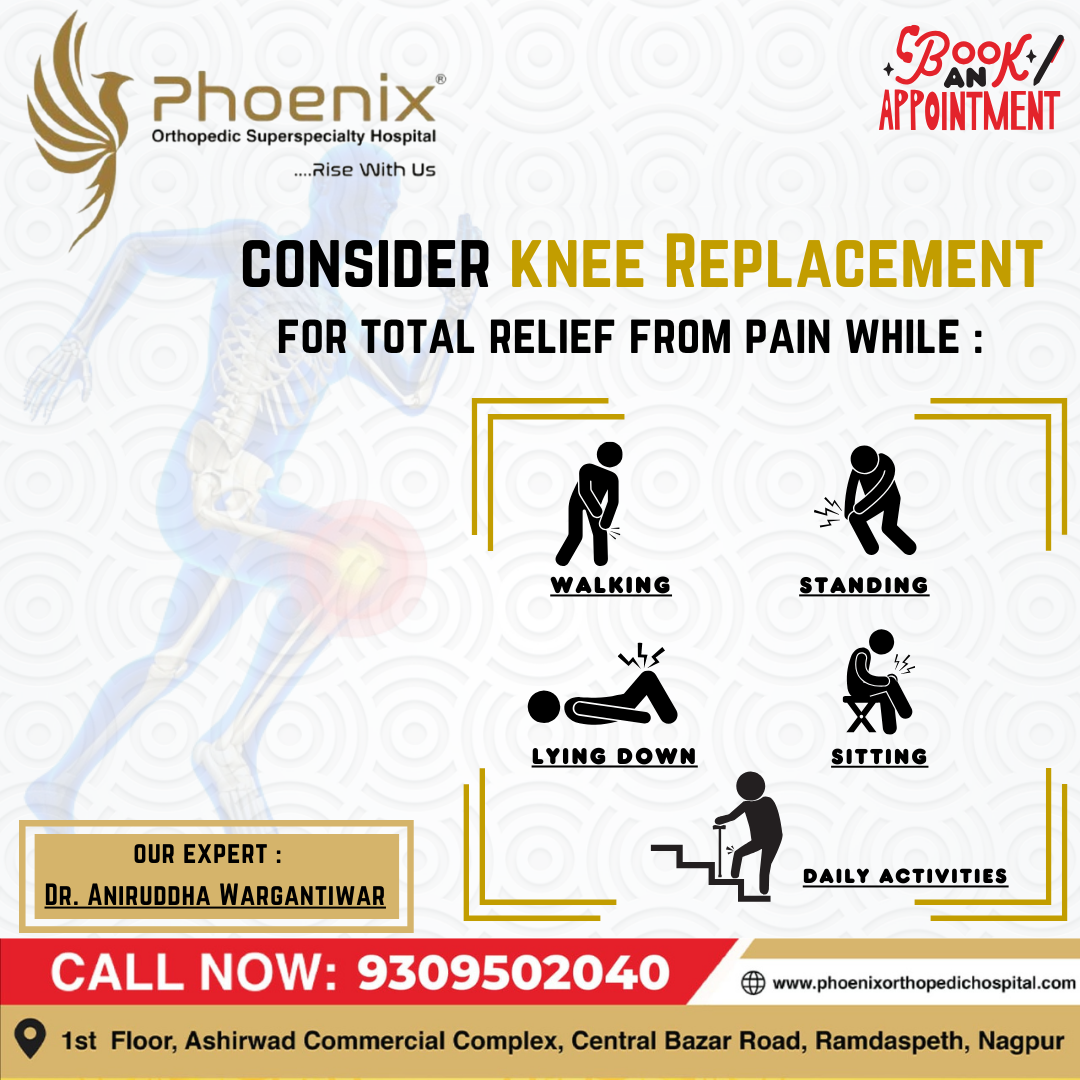 Total knee replacement (TKR) is a surgical proc... main image