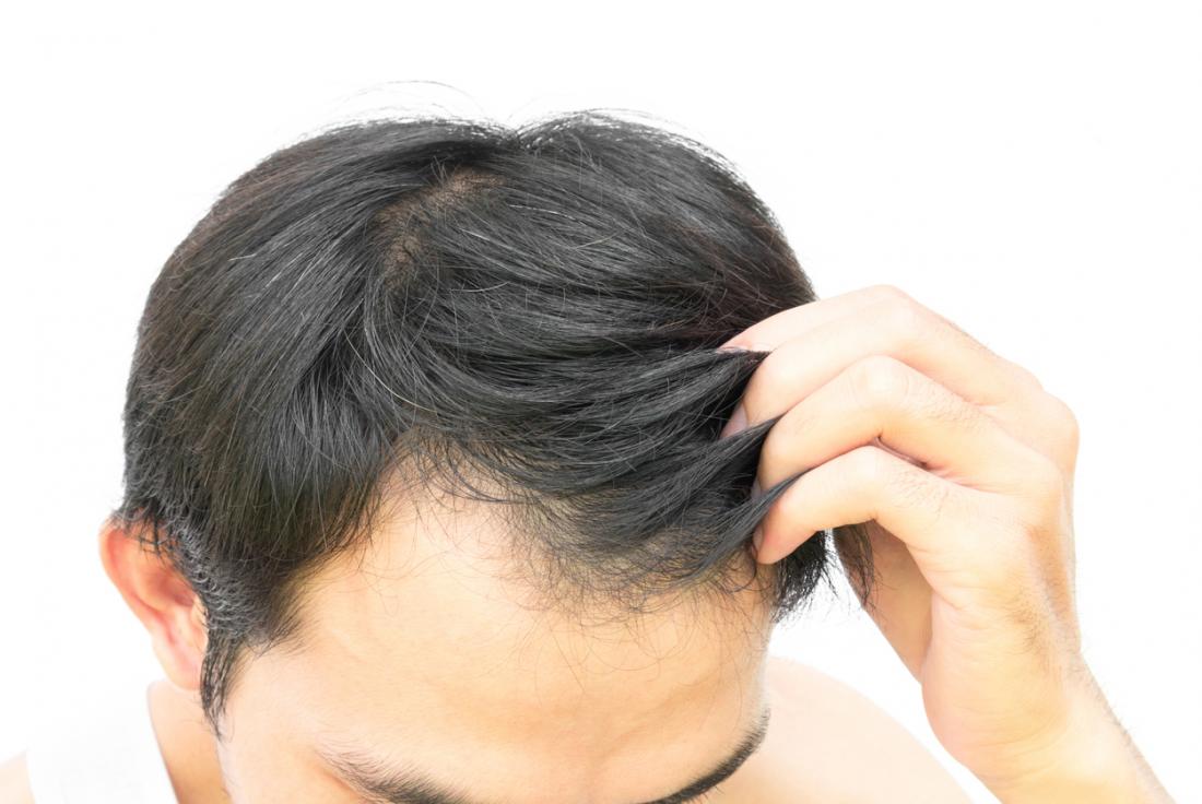 🌟 **Revitalize Your Hair with Dr. Narendra Niku... main image