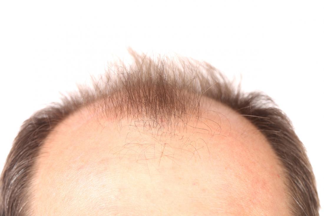 
🌿 Revitalize Your Strands: Dr. Narendra Nikumb... main image