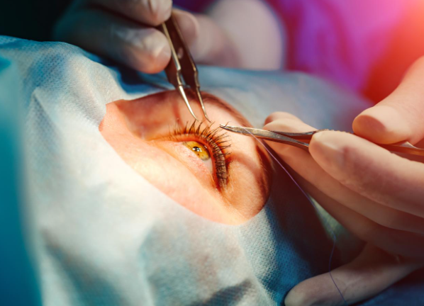 A Comprehensive Guide to Advanced Glaucoma and ... main image