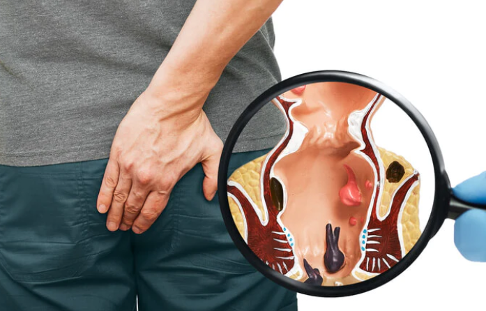 Piles and Fissures: A Holistic Approach at Dr. ... main image