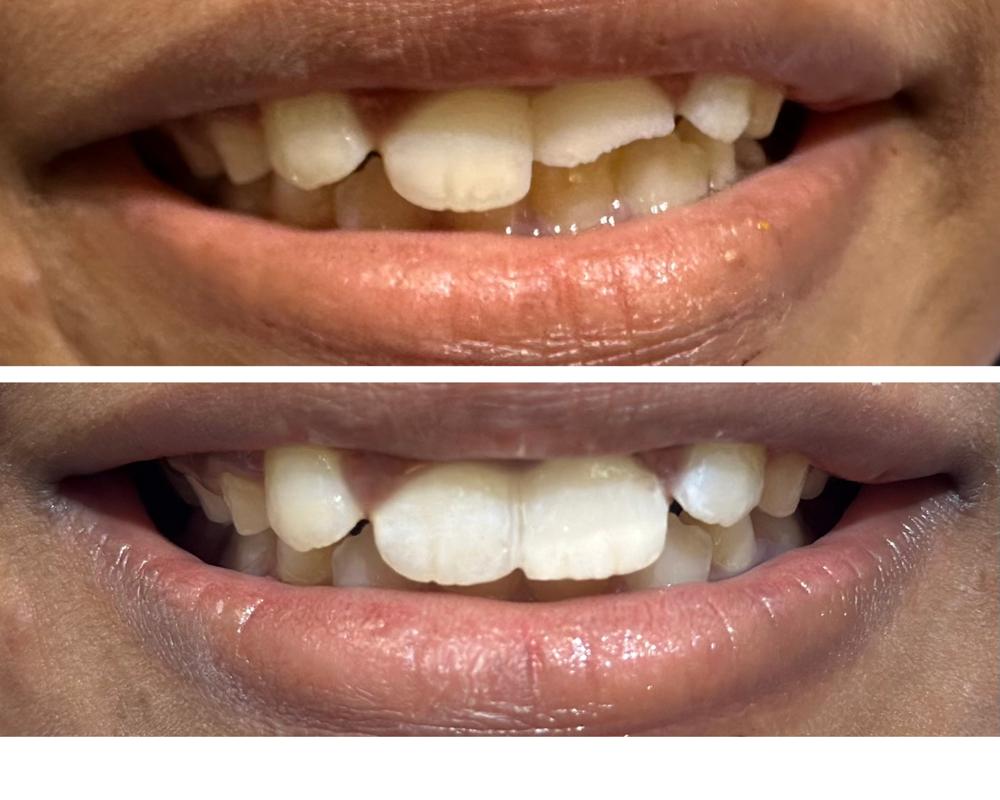 Emergency dental trauma can be distressing, but sw... main image