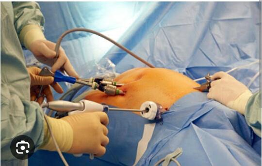 Precision in Practice: Dr. Rajiv Manek's Master... main image