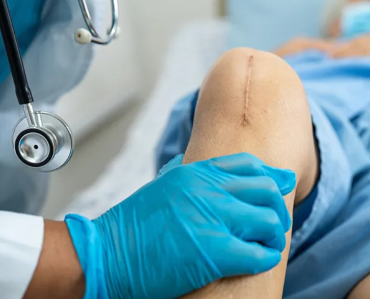 Joint Replacement Excellence at Medinova Super Spe... main image