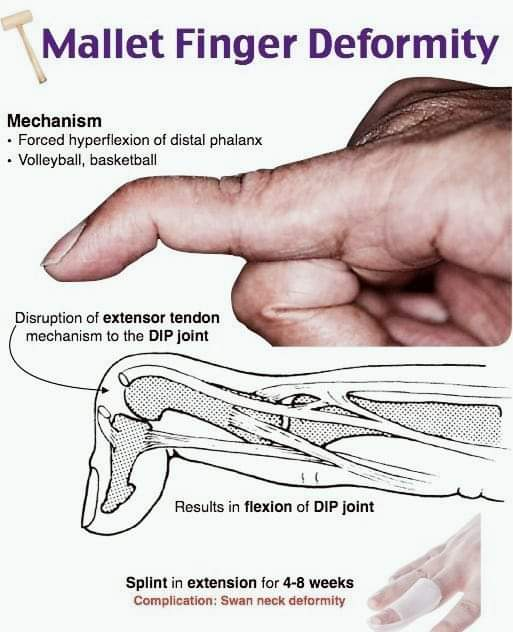 Physiotherapy clinic in Tambaram
Are you Looking f... main image