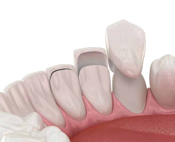 Transforming Smiles: Best Cosmetic Center in Ja... main image
