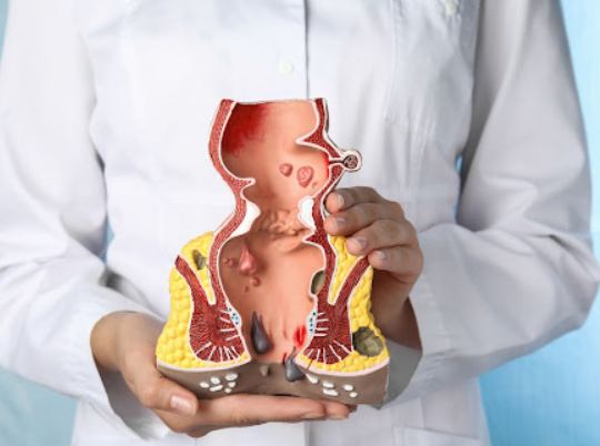 Piles and Fissures: The Importance of Early Det... main image