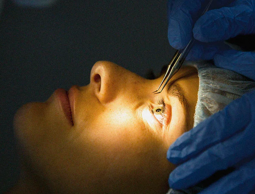 Clear Vision Ahead: The Benefits of Lasik Laser... main image