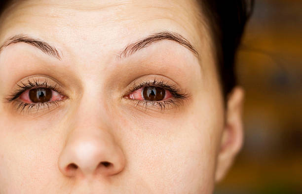 Comprehensive Glaucoma Treatment Solutions at I... main image