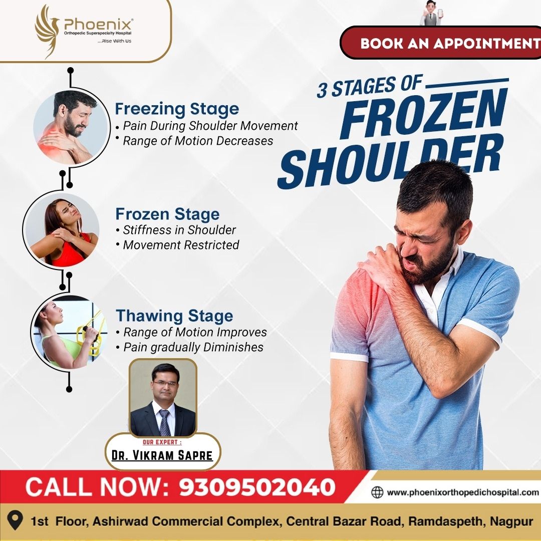 3 Stages of frozen shoulder 1) Freezing Stage 2) F... main image
