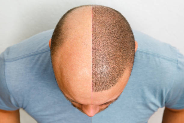 Restore Your Crowning Glory at Medisky Multispe... main image