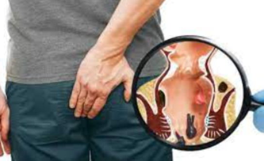 Expert Piles Treatment at Dr. Phapale Hospital,... main image