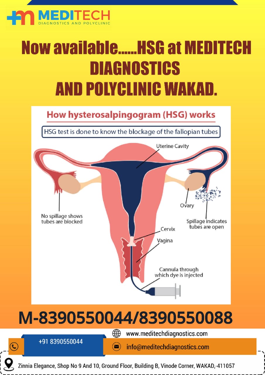 Hysterosalpingography (HSG), also known as uter... main image