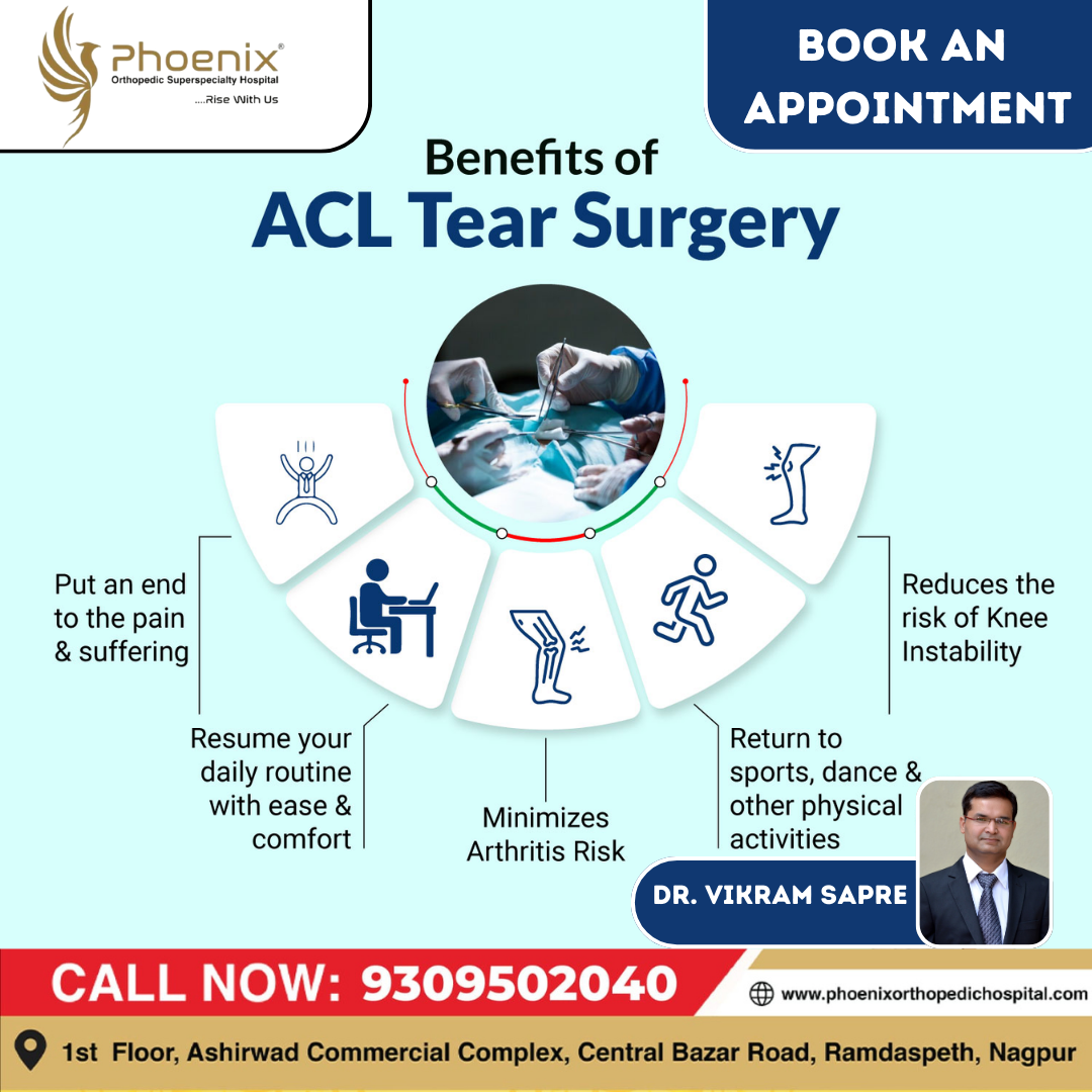 BENEFITS OF ACL TEAR SURGERY Consultants At : 1... main image