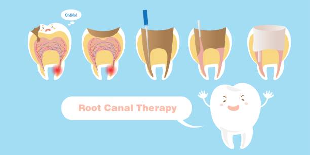 Transform Your Smile with Painless RCT at Dr. Rai'... main image