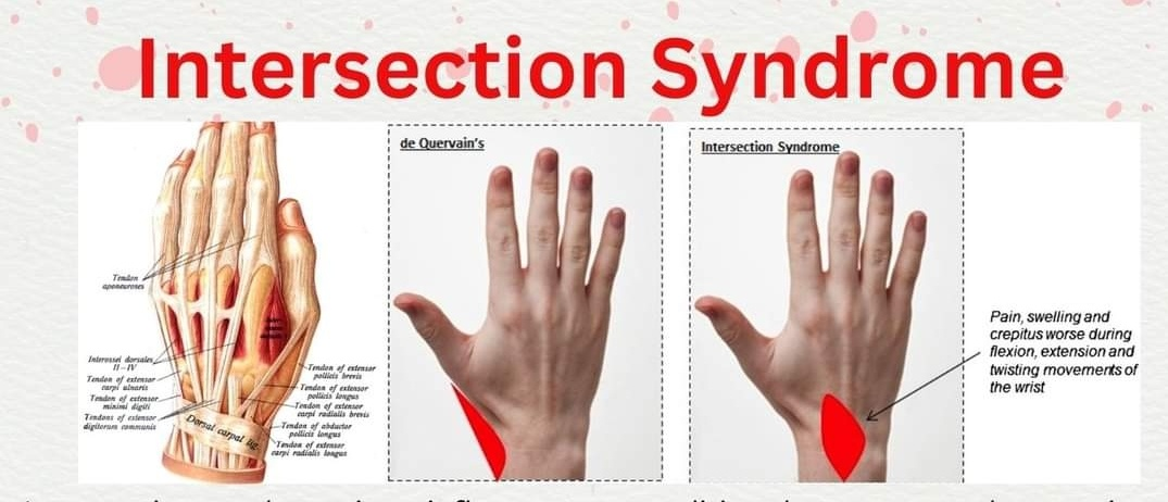 Physiotherapy clinic in Tambaram
Are you Looking f... main image