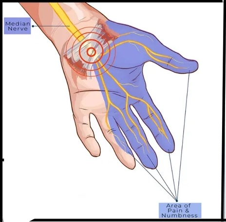 Physiotherapy clinic in Tambaram
Are you Looking f... main image