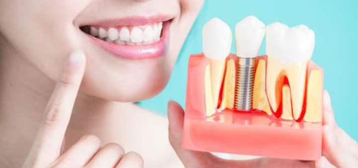Enhance Your Smile with Dental Implant Surgery at ... main image