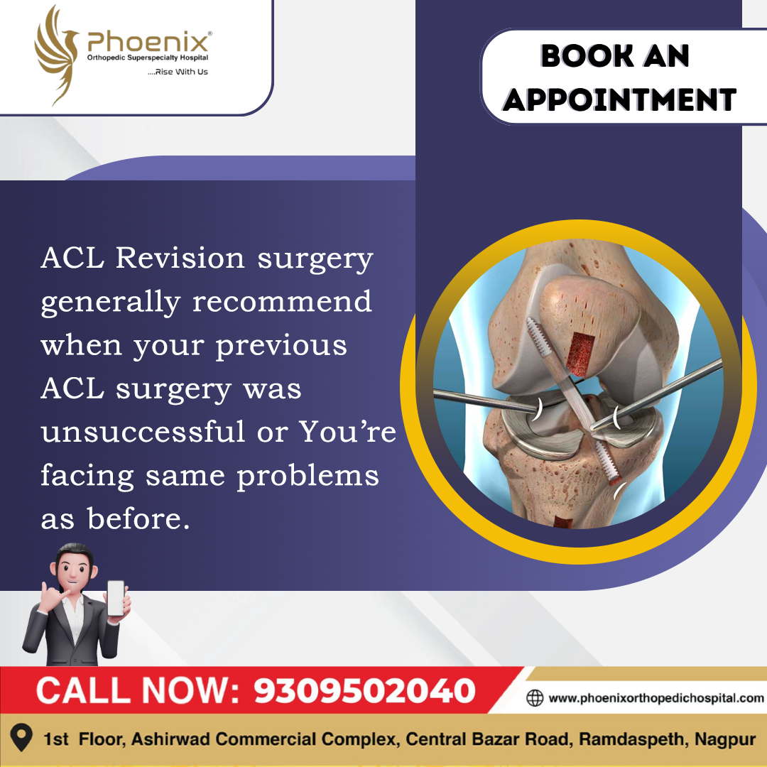 ACL Revision Surgery Generally Recommend When Y... main image