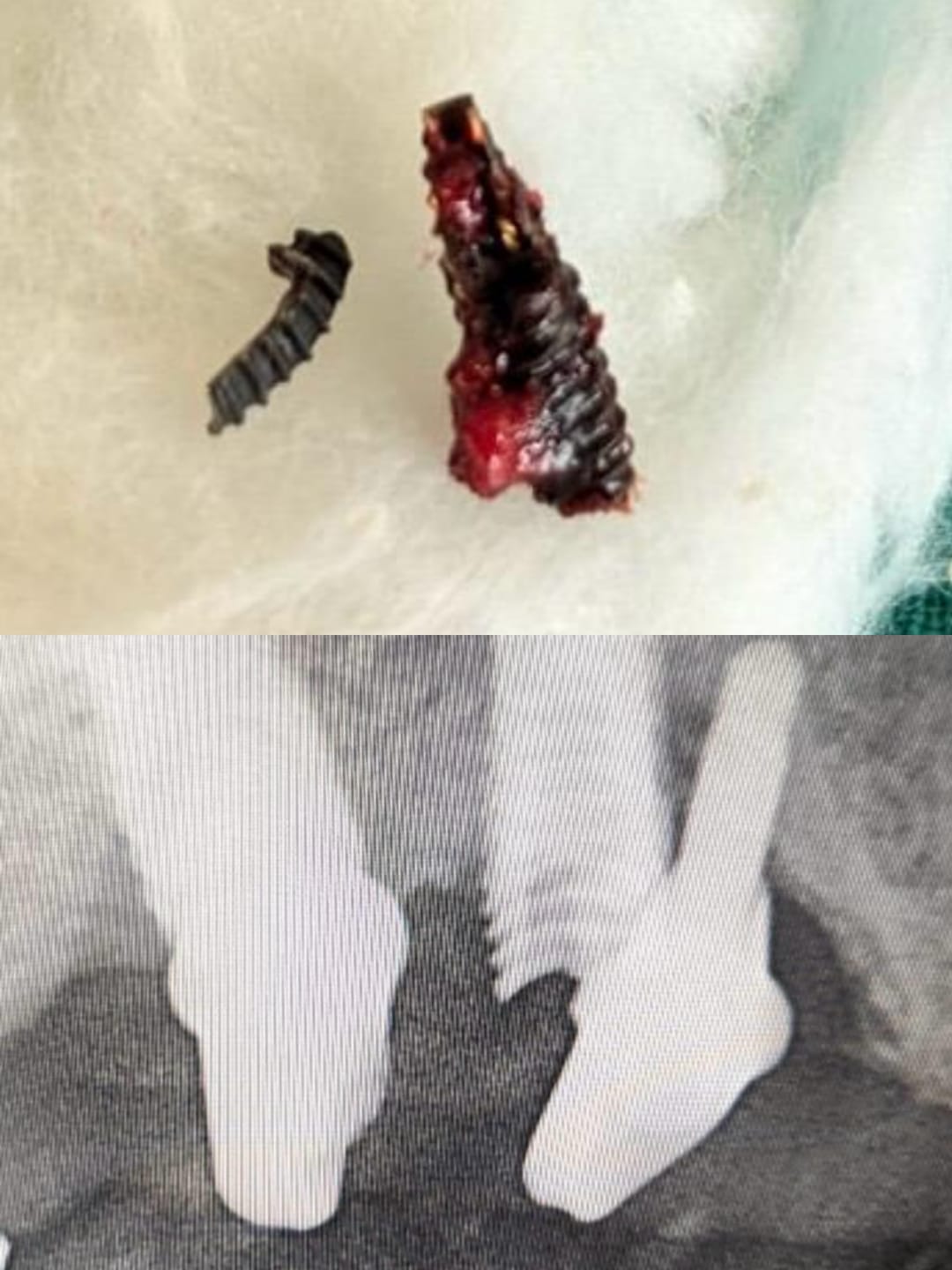 Transforming pain into relief! Salvaging a broken ... main image