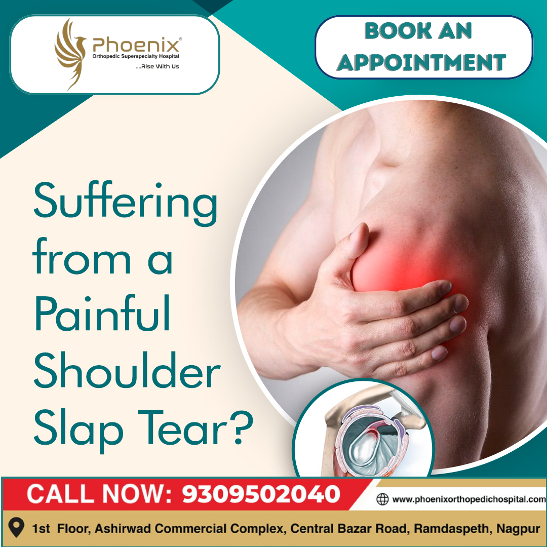 SUFFERING FROM A PAINFUL SHOULDER SLAP TEAR ? C... main image