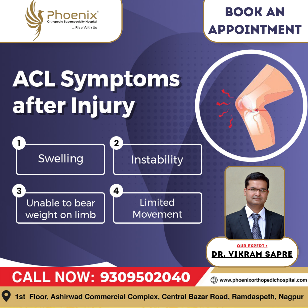 ACL Symptoms After injury Consultants At : 1st ... main image