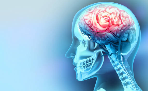 Pioneering Neurosurgery Techniques at Medinova Sup... main image