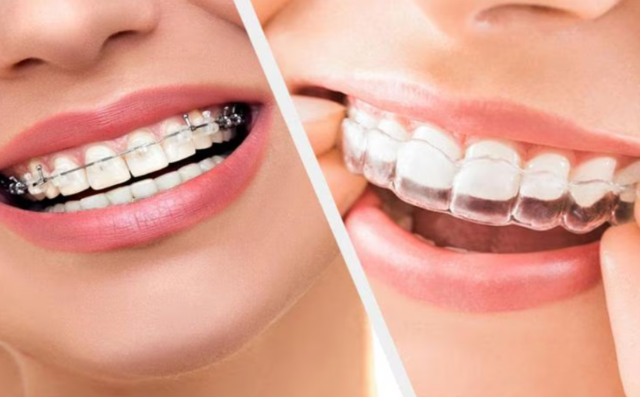 Straighten Your Smile with Braces Treatments at Dr... main image