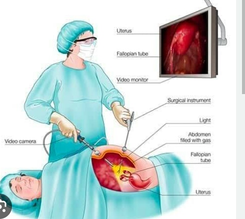 The Laser Precision: Dr. Rajiv Manek's Laparosc... main image