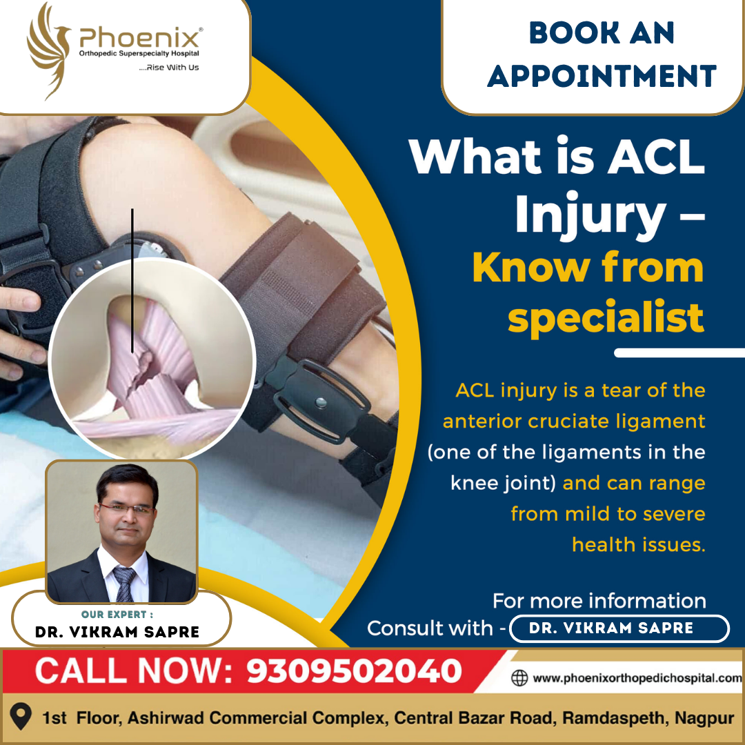 WHAT IS ACL INJURY ? Consultants At : 1st Floor, A... main image