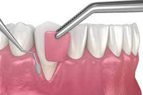 Finding the Best Dentist Near You in Jaipur You... main image