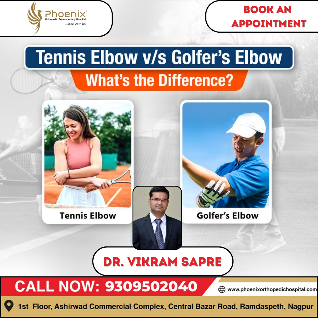 TENNIS ELBOW V/S GOLFER'S ELBOW WHAT'S THE DIFFERE... main image