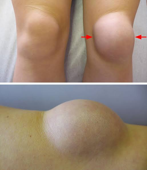 Looking for the best physiotherapy treatment in Ta... main image