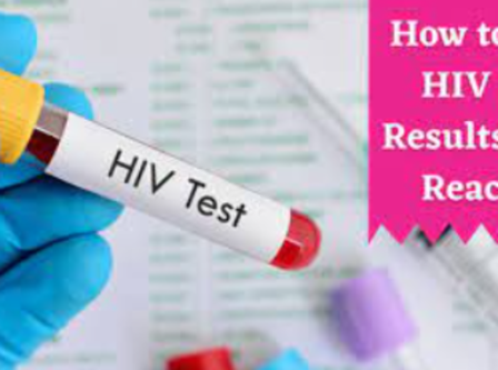 Cutting-Edge HIV Tests: Empowering Health in Hy... main image